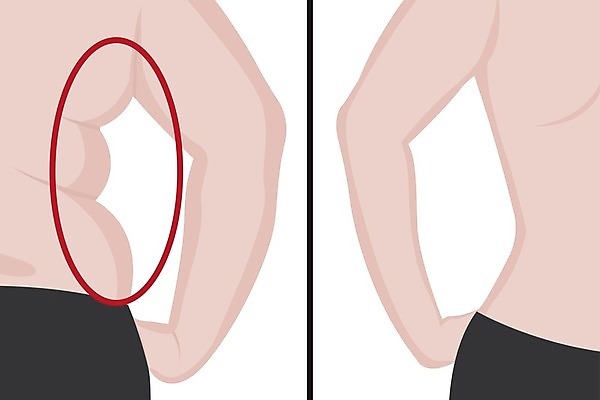 EPS 해외이미지 모양 라이프스타일 여자 스포츠 신체 다이어트 일러스트 건강 운동 숫자 흰색 수술 몸무게 큼 엉덩이 비만 날씬함 허리 연습 외과 얇은 적자 해로움 전후 셀룰라이트 해외202004 해외일러스트 문자 컬러 컨셉 의학 병원 사람 생활 신체부위 비교 크기 몸매 파일형식 벡터 이미지허브