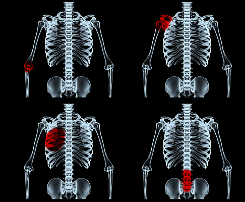 포토 JPG 해외이미지 척추동물 신체 일러스트 해부 뼈 골격 엑스레이 사람 사람없음 그래픽 3D 환자 흉부 생물학 만들기 방사선 해외202004 해외포토 동물 교육 의학 모션 호흡기관 디지털합성 파일형식 이미지허브