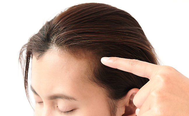 포토 JPG 해외이미지 여자 한명 상반신 성인 뷰티 머리카락 머리 가리킴 흰배경 두피 두피관리 두피케어 탈모 탈모클리닉 성인여자한명만 해외202004 탈모예방 해외포토 1 백그라운드 사람 손짓 신체부위 흰색 예방 클리닉 헤어관리 증상 여자한명만 성인여자만 파일형식 이미지허브