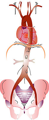 EPS 클립아트 신체 일러스트 해부 의학 사람 사람없음 치료 심장 내장 장기 순환기관 국내일러스트 장기_의학 파일형식 벡터