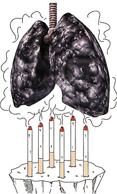 편집이미지 포토일러 흡연 담배 건강 병원 사람없음 치료 죽음 허파 연기 장기 질병 담배연기 폐암 이미지편집 AI파일 신체 의학 호흡기관 암 파일형식 벡터