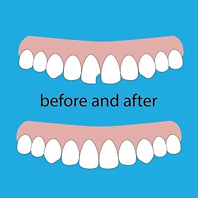 EPS 해외이미지 디자인 배너 얼굴 컨셉 일러스트 설계 건강 치과 병원 성인 치료 약 기계 손상 의사 입 치아 보호 결과 질병 부식 치과의사 레이아웃 약속 파란배경 심플 틀니 돌봄 복원 못생김 해외202004 해외일러스트 백그라운드 의학 모션 사람 신체부위 파란색 의료진 소화기관 파일형식 벡터 이미지허브