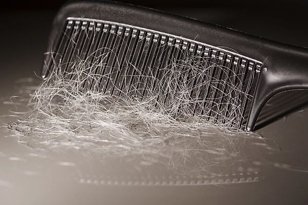 포토 JPG 해외이미지 검은배경 근접촬영 사람없음 뷰티 머리카락 머리빗 두피관리 두피케어 탈모 탈모클리닉 해외202004 탈모예방 해외포토 뷰포인트 백그라운드 머리 검은색 미용용품 예방 클리닉 헤어관리 증상 파일형식 이미지허브