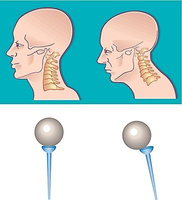 EPS 해외이미지 얼굴 십자가 신체 일러스트 부분 그래프 뼈 골격 건강 사람 약 머리 질병 척추 그림 목 혹 해외202004 해외일러스트 의학 신체부위 파일형식 벡터 이미지허브
