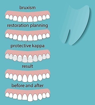 EPS 해외이미지 디자인 배너 얼굴 컨셉 일러스트 설계 건강 치과 병원 미소 성인 치료 약 기계 손상 의사 입 치아 보호 결과 질병 치과의사 레이아웃 약속 파란배경 심플 틀니 돌봄 복원 아크릴 못생김 해외202004 해외일러스트 백그라운드 의학 모션 재질 표정 사람 신체부위 파란색 의료진 소화기관 파일형식 벡터 이미지허브