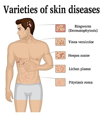EPS 해외이미지 손 신체 일러스트 해부 종류 사람 치료 약 환경오염 질병 상처 흉부 피부 사인 목 테라피 타입 면역력 증상 해외202004 해외일러스트 컨셉 의학 신체부위 뷰티 호흡기관 파일형식 벡터 이미지허브
