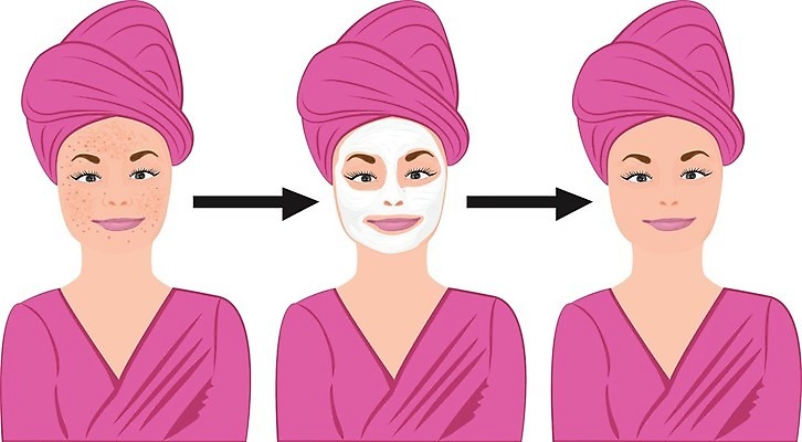 EPS 해외이미지 여자 얼굴 지도 신체 일러스트 표면 세포 건강 사람 치료 빨간색 약 인포그래픽 결과 피부 흰배경 감염 문제 스킨케어 타입 박테리아 여드름 돌봄 염증 효과 해외202004 해외일러스트 컬러 백그라운드 컨셉 의학 모션 신체부위 뷰티 흰색 질병 파일형식 벡터 이미지허브