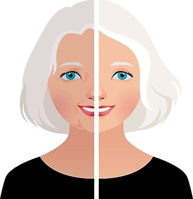EPS 해외이미지 백인 얼굴 일러스트 성인 치료 뷰티 화장품 흰색 주름 플라스틱 피부 피부관리 리프트 외과 방법 전후 해외202004 해외일러스트 서양인 컬러 의학 재질 병원 사람 신체부위 비교 파일형식 벡터 이미지허브