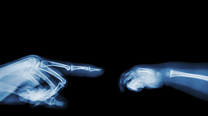 포토 JPG 해외이미지 손 배너 어린이 백그라운드 손가락 해부 뼈 골격 엑스레이 건강 병원 손바닥 사람 성인 사람없음 파란색 숫자 약 검은색 공백 환자 광선 아기 신생아 X 손목 필름 인덱스 팔 질서 명령 고립 돌봄 정형외과 해외202004 해외포토 문자 알파벳 컬러 의학 모션 신체부위 예절 파일형식 이미지허브