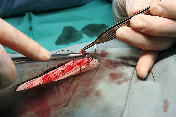 포토 JPG 해외이미지 손 무기 장갑 탁자 집게 관리 가면 사람없음 초록색 약 의사 도구 공구 수술 닫기 호흡 상처 바느질 문서 땀 팔 핀셋 외과 수의사 라텍스 바늘땀 작동 해외202004 해외포토 잡화 컬러 가구 의학 모션 병원 신체부위 치료 의료진 파일형식 이미지허브