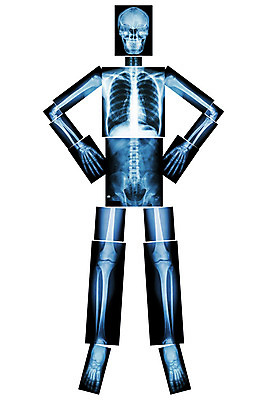 포토 JPG 해외이미지 포즈 신체 부분 해부 뼈 골격 엑스레이 건강 병원 미술 서기 사람 사람없음 약 검은색 고통 환자 의사 광선 흰색 퍼즐 오르간 질병 X 생물학 위치 고립 돌봄 방사선 정형외과 해외202004 해외포토 알파벳 교육 감정 컬러 의학 모션 문화예술 의료진 건반악기 파일형식 이미지허브