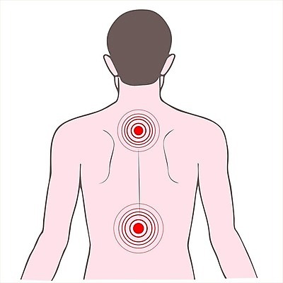 EPS 해외이미지 포즈 신체 일러스트 해부 건강 사람 치료 약 고통 환자 긴급 대접 마사지 질병 위험 공격 지압 약국 척추 목 문제 불평 요통 증상 화상 해외202004 해외일러스트 감정 컨셉 의학 모션 뼈 신체부위 상처 허리통증 파일형식 벡터 이미지허브