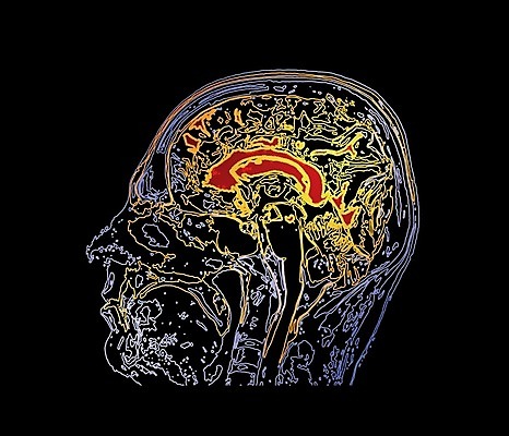 EPS 해외이미지 백그라운드 지도 일러스트 해부 엑스레이 건강 실험 사람 치료 약 머리 검은색 고양이 환자 광선 흰색 실험실 질병 X 필름 뇌 지형 외과 방사선 종양 해골모형 해외202004 해외일러스트 알파벳 컬러 포유류 의학 병원 신체부위 반려동물 모형 파일형식 벡터 이미지허브