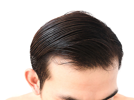 포토 JPG 해외이미지 남자 한명 근접촬영 성인 뷰티 머리카락 머리 흰배경 두피관리 두피케어 탈모 탈모클리닉 성인남자한명만 해외202004 탈모예방 해외포토 1 뷰포인트 백그라운드 사람 신체부위 흰색 예방 클리닉 헤어관리 증상 남자한명만 성인남자만 파일형식 이미지허브