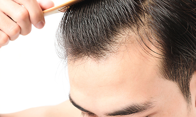 포토 JPG 해외이미지 남자 한명 들기 근접촬영 성인 뷰티 머리카락 머리 머리빗 흰배경 두피관리 두피케어 탈모 탈모클리닉 성인남자한명만 해외202004 탈모예방 해외포토 1 뷰포인트 백그라운드 모션 사람 신체부위 흰색 미용용품 예방 클리닉 헤어관리 증상 남자한명만 성인남자만 파일형식 이미지허브