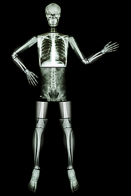 포토 JPG 해외이미지 포즈 신체 부분 해부 뼈 골격 엑스레이 건강 병원 선물 미술 서기 들기 사람 사람없음 약 고통 환자 의사 광선 퍼즐 오르간 질병 X 생물학 리프트 위치 외과 고립 돌봄 방사선 정형외과 해외202004 해외포토 알파벳 교육 감정 의학 모션 문화예술 의료진 건반악기 파일형식 이미지허브