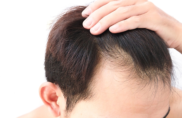 포토 JPG 해외이미지 남자 한명 근접촬영 상반신 성인 뷰티 머리카락 머리 흰배경 두피관리 두피케어 탈모 탈모클리닉 성인남자한명만 해외202004 탈모예방 해외포토 1 뷰포인트 백그라운드 사람 신체부위 흰색 예방 클리닉 헤어관리 증상 남자한명만 성인남자만 파일형식 이미지허브