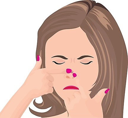 EPS 해외이미지 여자 얼굴 지도 신체 일러스트 표면 세포 건강 사람 치료 빨간색 약 인포그래픽 상품 피부 흰배경 감염 문제 스킨케어 타입 박테리아 여드름 돌봄 염증 짜기 효과 해외202004 해외일러스트 컬러 백그라운드 의학 모션 신체부위 뷰티 흰색 질병 파일형식 벡터 이미지허브