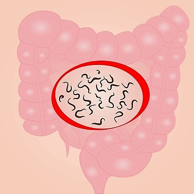 EPS 해외이미지 백그라운드 컨셉 일러스트 건강 사람 내부 원형 오르간 벌레 질병 작음 생물학 감염 미생물 시스템 애벌레 기생충 나쁜 그만 해외202004 해외일러스트 도형 교육 곤충 의학 생물 건반악기 바이러스 크기 파일형식 벡터 이미지허브
