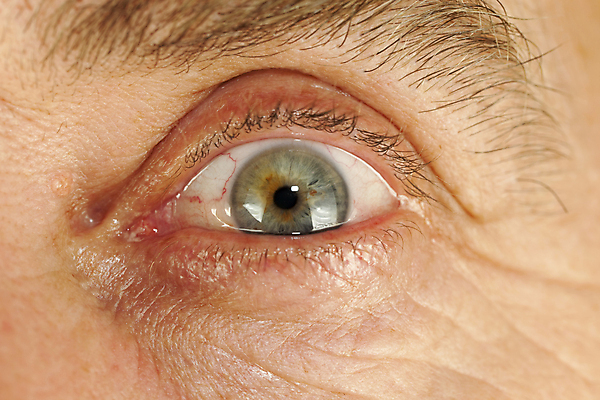 포토 JPG 해외이미지 학생 한명 사람 펼침 고통 주름 눈동자 속눈썹 피부 해외202004 해외포토 1 감정 모션 신체부위 눈_신체부위 눈썹 파일형식 이미지허브