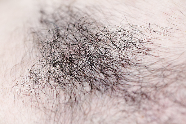 포토 JPG 해외이미지 남자 근접촬영 뷰티 머리카락 머리 대머리 두피 두피관리 두피케어 탈모 탈모클리닉 해외202004 탈모예방 해외포토 헤어스타일 뷰포인트 사람 신체부위 예방 클리닉 헤어관리 증상 파일형식 이미지허브