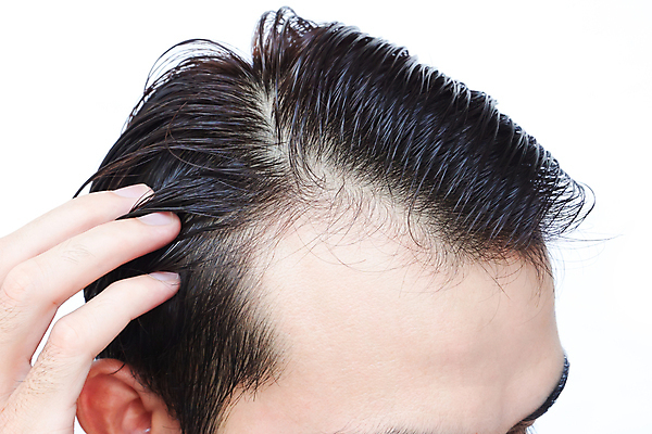 포토 JPG 해외이미지 남자 한명 근접촬영 성인 뷰티 머리카락 머리 잡기 흰배경 두피관리 두피케어 탈모 탈모클리닉 성인남자한명만 해외202004 탈모예방 해외포토 1 뷰포인트 백그라운드 모션 사람 신체부위 흰색 예방 클리닉 헤어관리 증상 남자한명만 성인남자만 파일형식 이미지허브