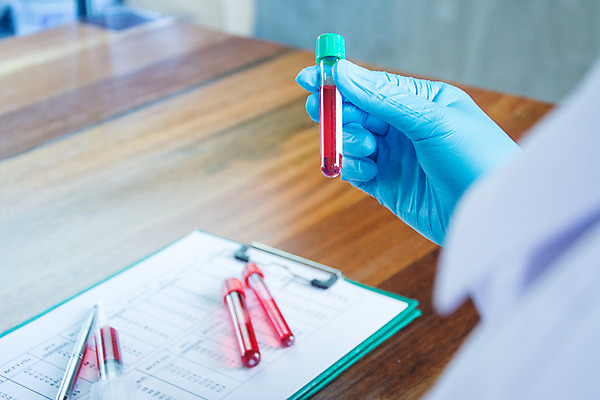 포토 JPG 해외이미지 여자 교육 남자 아시아 얼굴 컨셉 유리 건강 병원 실험 사람 동양인 성인 사람없음 파란색 약 장비 의사 코트 액체 실험실 DNA 생명공학 플라스크 분석 생물학 비커 유리그릇 발견 화학물질 화학자 해외202004 해외포토 그릇 나라 컬러 의학 재질 실험기구 인종 신체부위 외투 의료진 화학 과학자 파일형식 이미지허브