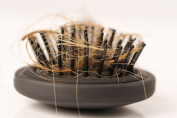 포토 JPG 해외이미지 근접촬영 사람없음 아웃포커스 뷰티 머리카락 머리빗 흰배경 두피케어 탈모 탈모클리닉 해외202004 탈모예방 해외포토 뷰포인트 백그라운드 촬영기법 머리 흰색 미용용품 예방 클리닉 헤어관리 증상 파일형식 이미지허브