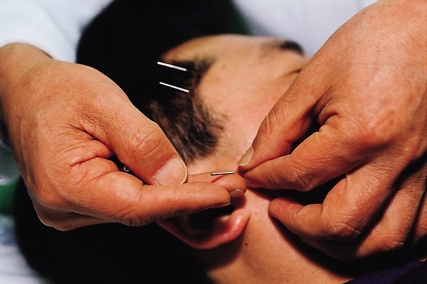 포토 JPG 손 남자 얼굴 의학 실내 한명 사람 20대 성인 신체부위 치료 한의학 의료용품 귀 한의원 침술 청년만 성인한명만 성인만 국내포토 1 의료기기 병원 청년 내부 파일형식