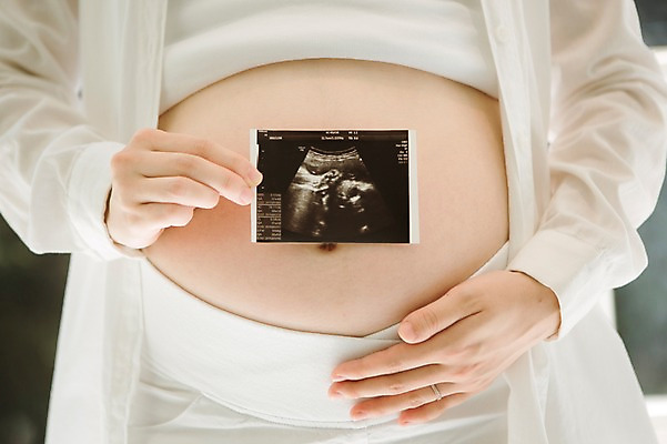 포토 JPG 스튜디오촬영 여자 엄마 실내 사랑 한명 들기 상반신 앞모습 30대 희망 임산부 한국인 보호 준비 설레임 초음파사진 복부 성인여자만 성인여자한명만 장년여자한명만 국내포토 1 감정 뷰포인트 컨셉 가족 모션 사람 동양인 내부 신체부위 장년 임신 여자만 여자한명만 장년여자만 성인만 파일형식