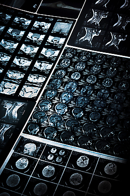 포토 JPG 해외이미지 엑스레이 건강 병원 실험 사람없음 치료 머리 힘 광선 마음 실험실 결과 질병 정상 미끄럼틀 X 사건 필름 분석 뇌 보고서 암 방사선 배기가스 부정적 스캔 정신과 종양 해외202004 해외포토 알파벳 감정 컨셉 의학 신체부위 놀이기구 파일형식 이미지허브