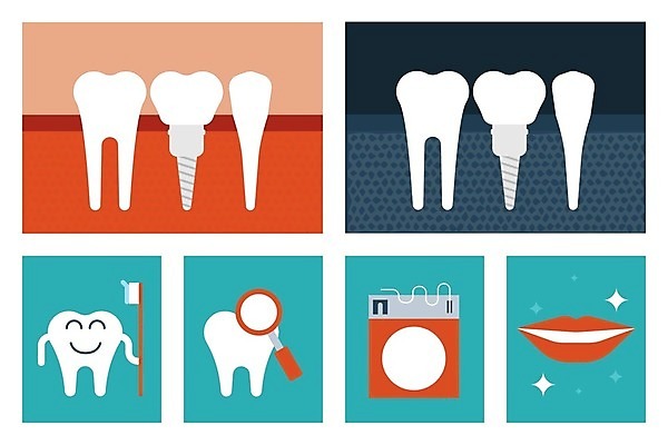 EPS 해외이미지 일러스트 건강 치과 미소 사람없음 입 치아 칫솔 입술 미백 위생관리 임플란트 치아건강 해외202004 해외일러스트 표정 병원 관리 신체부위 위생용품 소화기관 파일형식 벡터 이미지허브