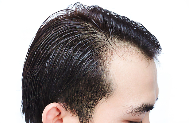 포토 JPG 해외이미지 남자 한명 근접촬영 성인 뷰티 머리카락 머리 흰배경 두피관리 두피케어 탈모 탈모클리닉 성인남자한명만 해외202004 탈모예방 해외포토 1 뷰포인트 백그라운드 사람 신체부위 흰색 예방 클리닉 헤어관리 증상 남자한명만 성인남자만 파일형식 이미지허브