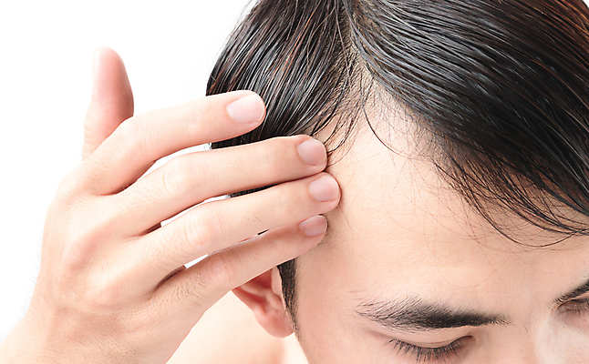 포토 JPG 해외이미지 남자 한명 근접촬영 성인 뷰티 머리카락 머리 흰배경 넘기 두피관리 두피케어 탈모 탈모클리닉 성인남자한명만 해외202004 탈모예방 해외포토 1 뷰포인트 백그라운드 모션 사람 신체부위 흰색 예방 클리닉 헤어관리 증상 남자한명만 성인남자만 파일형식 이미지허브