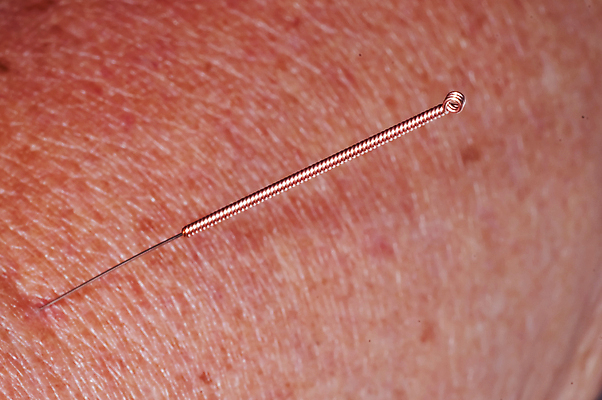 포토 JPG 해외이미지 전통 아시아 백그라운드 잎 자연 건강 동양인 사람없음 치료 초록색 약 중국 피부 대나무 부드러움 팔 돌봄 옛날 치유 해외202004 해외포토 나무 식물 나라 컬러 의학 모션 인종 신체부위 감각 생태계 파일형식 이미지허브