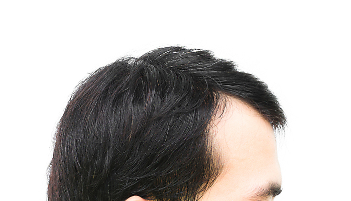 포토 JPG 해외이미지 남자 한명 근접촬영 성인 뷰티 머리카락 머리 흰배경 헤어관리 두피관리 두피케어 탈모 탈모클리닉 성인남자한명만 해외202004 탈모예방 해외포토 1 뷰포인트 백그라운드 사람 신체부위 흰색 예방 클리닉 증상 남자한명만 성인남자만 파일형식 이미지허브