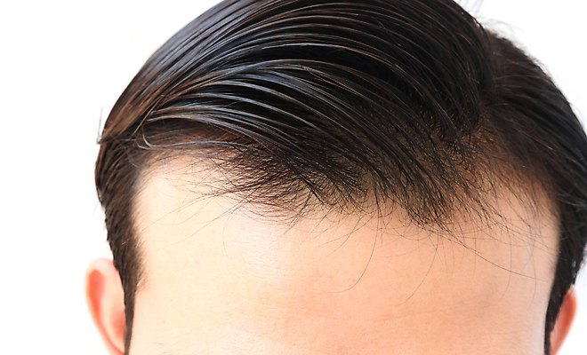 포토 JPG 해외이미지 남자 한명 근접촬영 성인 뷰티 머리카락 머리 흰배경 두피관리 두피케어 탈모 탈모클리닉 성인남자한명만 해외202004 탈모예방 해외포토 1 뷰포인트 백그라운드 사람 신체부위 흰색 예방 클리닉 헤어관리 증상 남자한명만 성인남자만 파일형식 이미지허브