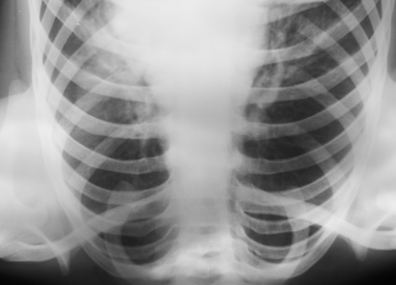 포토 JPG 해외이미지 해부 골격 엑스레이 건강 병원 그림자 사람 사람없음 디지털 검은색 환자 의사 광선 질병 X 척추 확인 보고서 전염 외과 궤 방사선 해외202004 해외포토 알파벳 컬러 의학 뼈 의료진 감염 파일형식 이미지허브