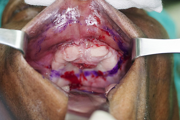 포토 JPG 해외이미지 직업 과학 장갑 실내 병원 사람없음 약 교수 환자 간호사 의사 관찰 수술 질병 약국 간호 집중 암 외과 돌봄 마약 방법 정형외과 치유 헬프 해외202004 해외포토 잡화 컨셉 의학 모션 내부 치료 교사 의료진 도움 파일형식 이미지허브