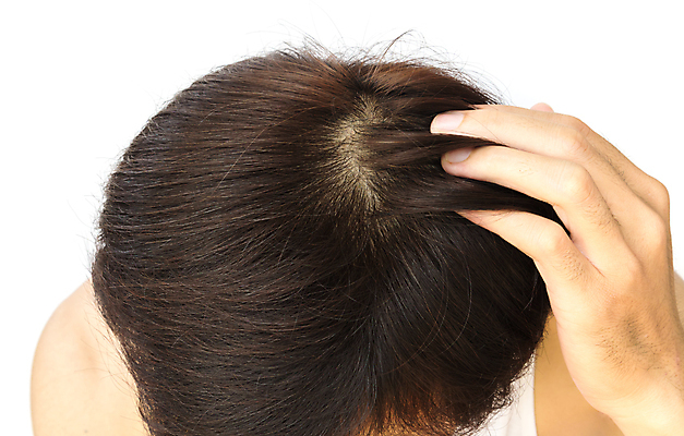 포토 JPG 해외이미지 남자 한명 근접촬영 성인 뷰티 머리카락 머리 잡기 흰배경 헤어관리 두피관리 두피케어 탈모 탈모클리닉 성인남자한명만 해외202004 탈모예방 해외포토 1 뷰포인트 백그라운드 모션 사람 신체부위 흰색 예방 클리닉 증상 남자한명만 성인남자만 파일형식 이미지허브