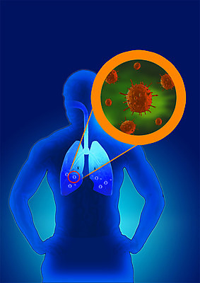 PSD 편집이미지 실루엣 의학 사람없음 허파 바이러스 박테리아 이미지편집 촬영기법 호흡기관 파일형식