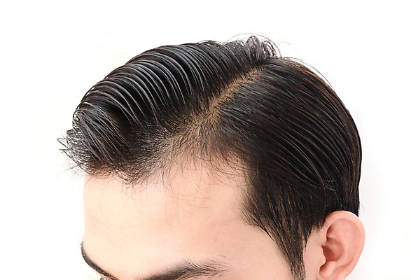 포토 JPG 해외이미지 남자 한명 근접촬영 성인 뷰티 머리카락 머리 흰배경 헤어관리 두피관리 두피케어 탈모 탈모클리닉 성인남자한명만 해외202004 탈모예방 해외포토 1 뷰포인트 백그라운드 사람 신체부위 흰색 예방 클리닉 증상 남자한명만 성인남자만 파일형식 이미지허브