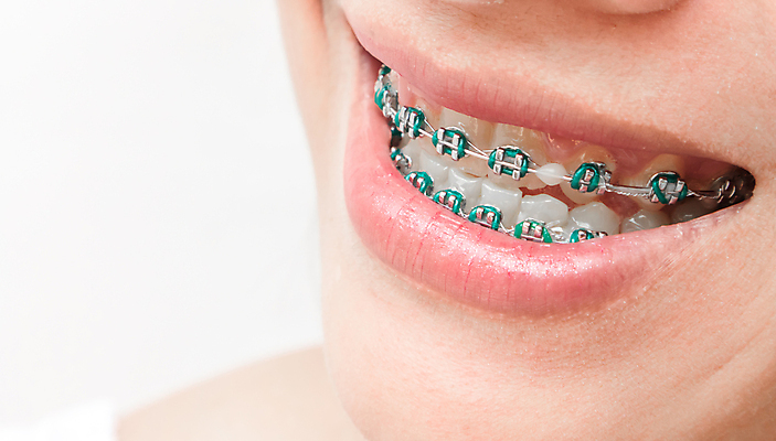 포토 JPG 해외이미지 여자 행복 얼굴 백그라운드 컨셉 건강 치과 병원 한명 미소 웃음 사람 성인 치료 금속 흰색 대접 오픈 도자기 입 투명 닫기 치아 B 묘사 입술 돌봄 완벽 위생관리 해외202004 해외포토 1 알파벳 감정 컬러 의학 모션 재질 표정 관리 신체부위 소화기관 파일형식 이미지허브