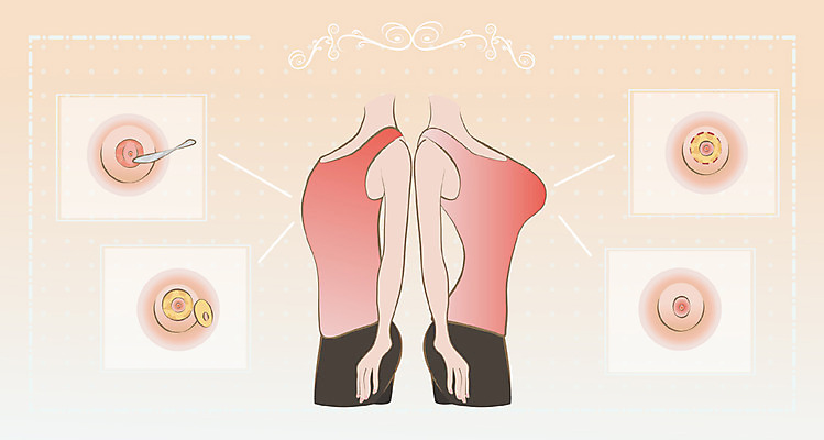 여자 일러스트 성인 두명 뷰티 성형수술 몸매 가슴수술 국내일러스트 AI파일 사람 수술 파일형식 벡터