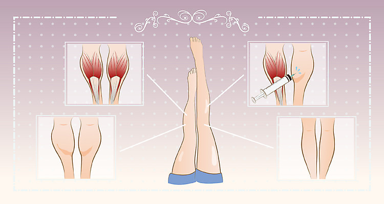 여자 일러스트 주사기 한명 성인 뷰티 성형수술 몸매 피부 종아리 보톡스 국내일러스트 AI파일 1 의료기기 사람 신체부위 수술 파일형식 벡터