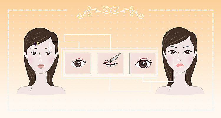 여자 얼굴 일러스트 성인 뷰티 눈 성형수술 피부 쌍꺼풀 국내일러스트 AI파일 자연요소 날씨 사람 신체부위 눈_신체부위 수술 파일형식 벡터