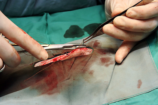 포토 JPG 해외이미지 손 무기 장갑 탁자 집게 관리 가면 사람없음 초록색 약 의사 도구 공구 수술 닫기 호흡 상처 바느질 문서 땀 팔 핀셋 외과 수의사 라텍스 바늘땀 작동 해외202004 해외포토 잡화 컬러 가구 의학 모션 병원 신체부위 치료 의료진 파일형식 이미지허브