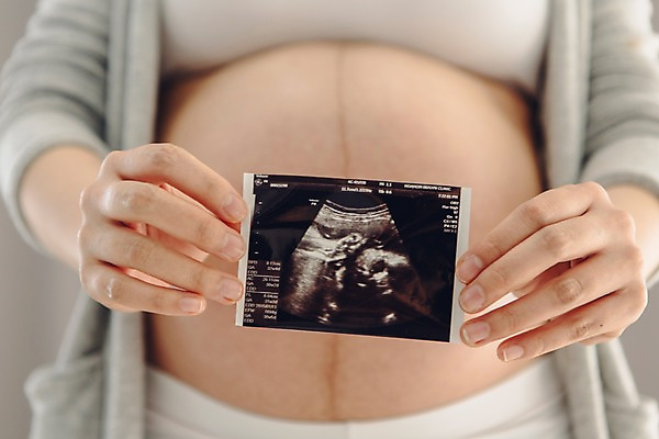 포토 JPG 손 여자 실내 한명 들기 상반신 20대 성인 앞모습 임산부 임신 한국인 초음파 초음파사진 복부 국내포토 1 뷰포인트 모션 사람 동양인 청년 내부 신체부위 파일형식