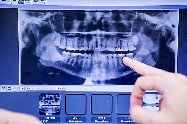 포토 JPG 백인 손 남자 한손 치과 한명 20대 성인 신체부위 노트북 가리킴 관찰 치과의사 CT촬영 국내포토 서양인 1 의료기기 모션 병원 사람 손짓 청년 전자제품 의사 파일형식
