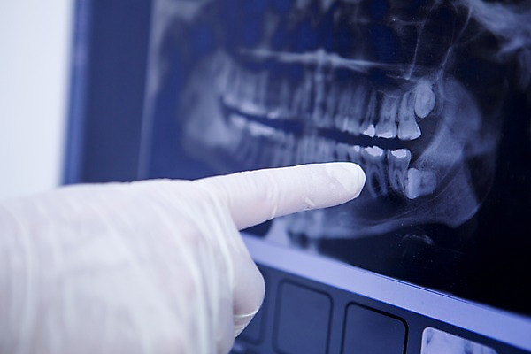 포토 JPG 백인 손 남자 한손 치과 한명 20대 성인 신체부위 노트북 가리킴 관찰 치과의사 CT촬영 국내포토 서양인 1 의료기기 모션 병원 사람 손짓 청년 전자제품 의사 파일형식